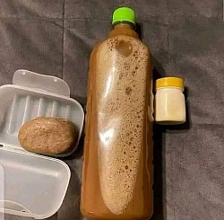 Acute pancreatitis